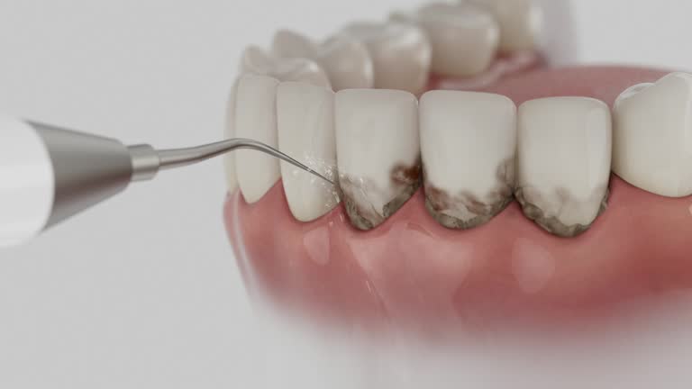 Trusted Teeth Cleaning And Checkup service in Monmouth, IL - Dentist Open Now